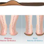 Aetrex L400 Women’s Pro-Shox Orthotics Arch Support Inserts – Shock Absorbing Plantar Fasciitis Relief Insoles for Women for Walking, Workouts and All-Day Support